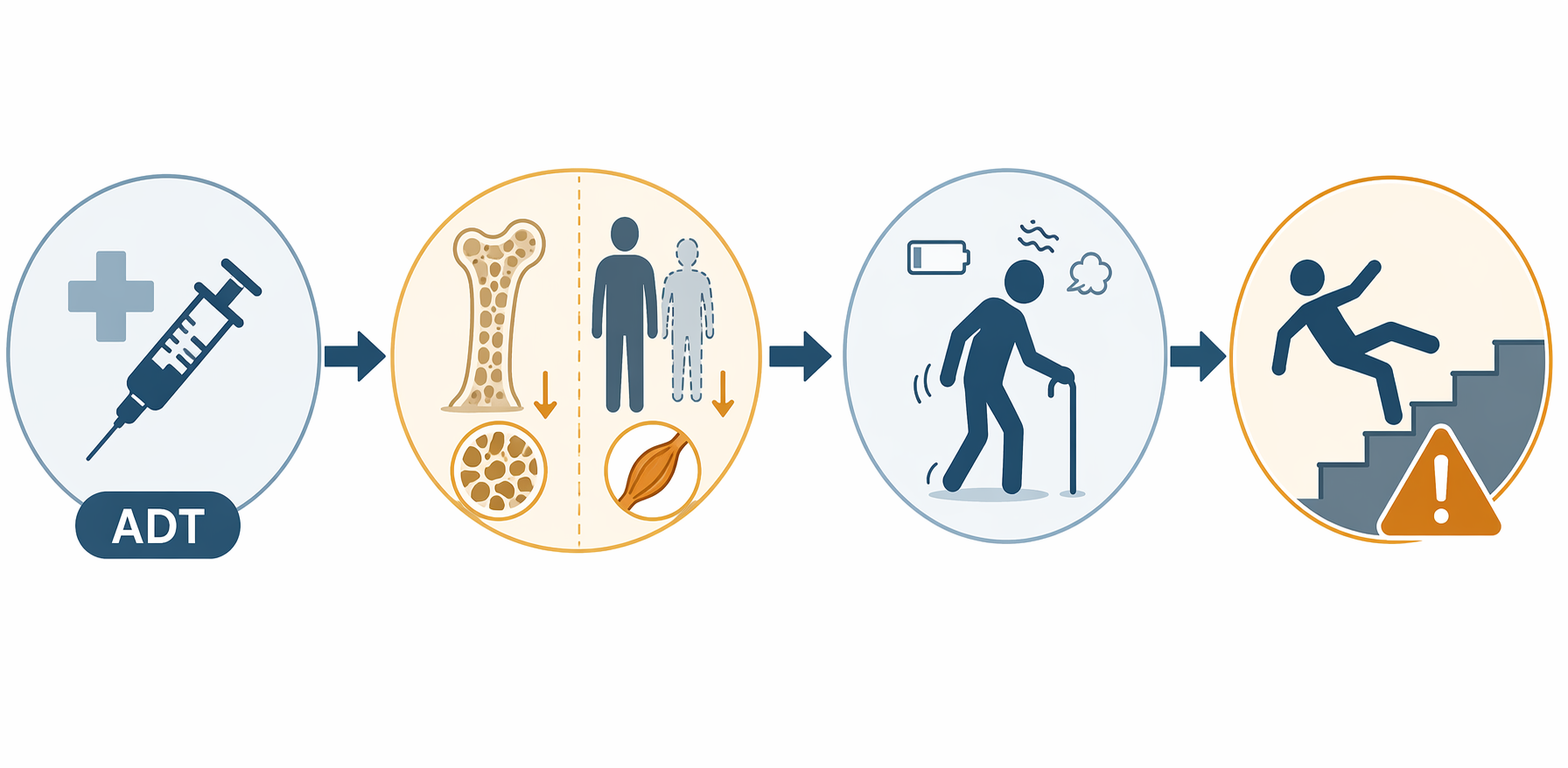 Flow diagram showing ADT leading to bone thinning, muscle loss, gait change, and fall hazard