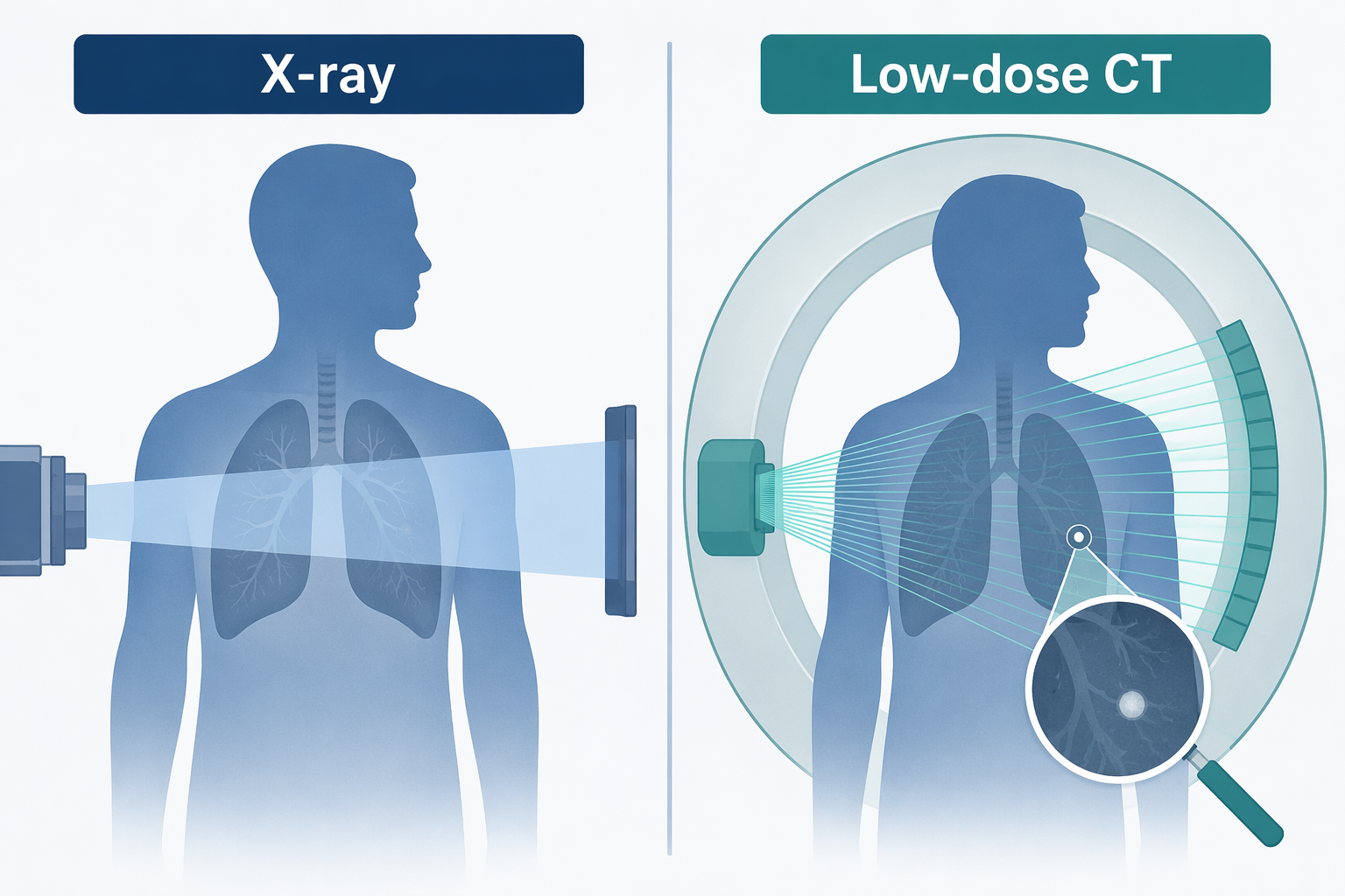 Conceptual comparison of chest X-ray missing a small lung nodule while low-dose CT detects it in cross-section